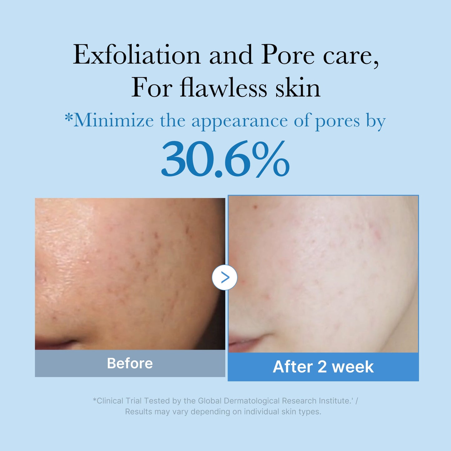 zero-pore-toner-v8 01_d6480b4e-3c08-4954-994a-ed5212c1839c.jpg