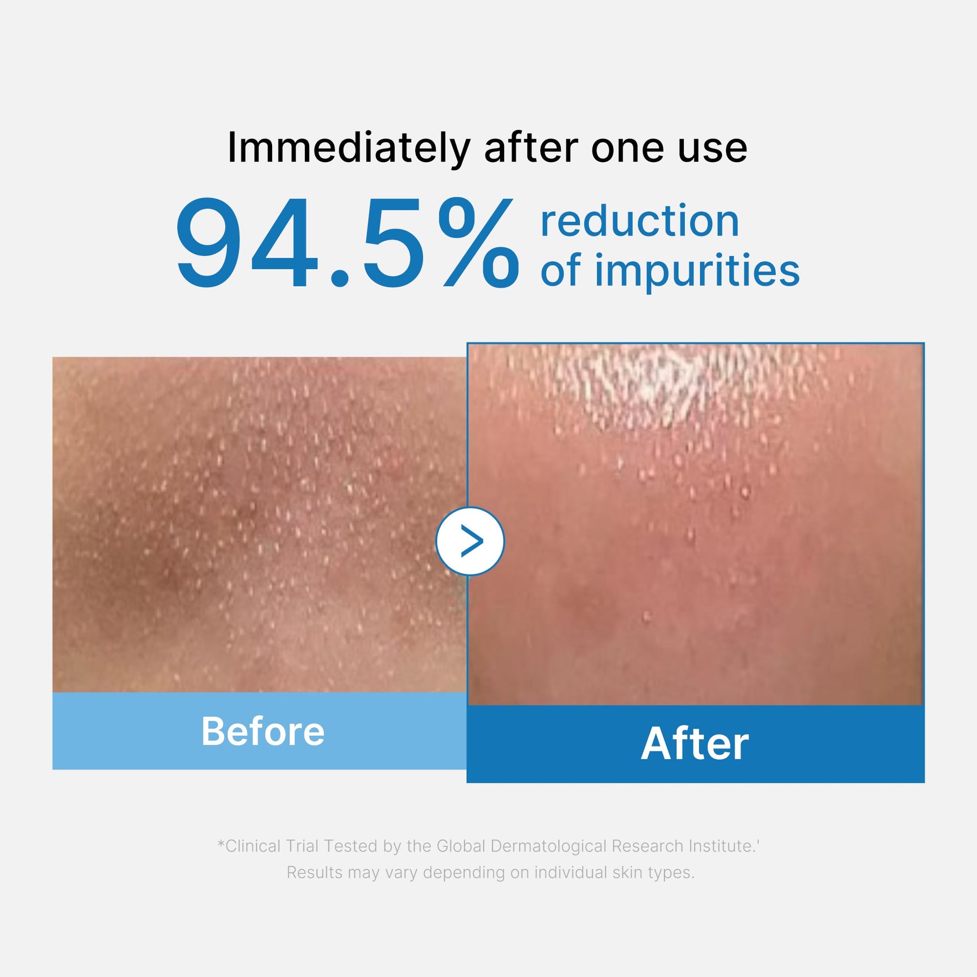 zero-pore-blackhead-deep-cleansing-oil-x5 01_eed557ec-5857-46a2-8b17-dbd67c692dcb.jpg