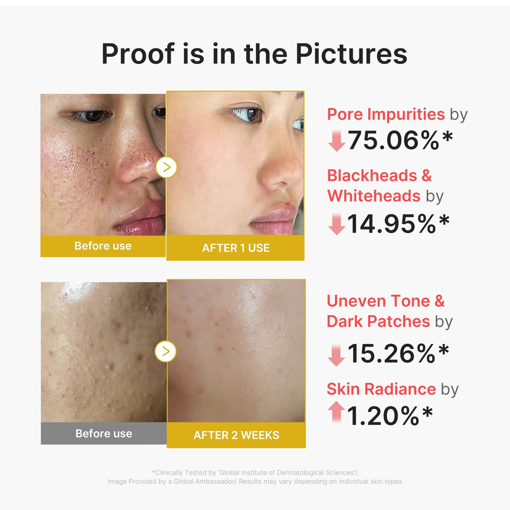 kojic-acid-turmeric-peel-shot-w9 02_45fe66d3-b3f6-4100-aa52-2afd7eded417.jpg