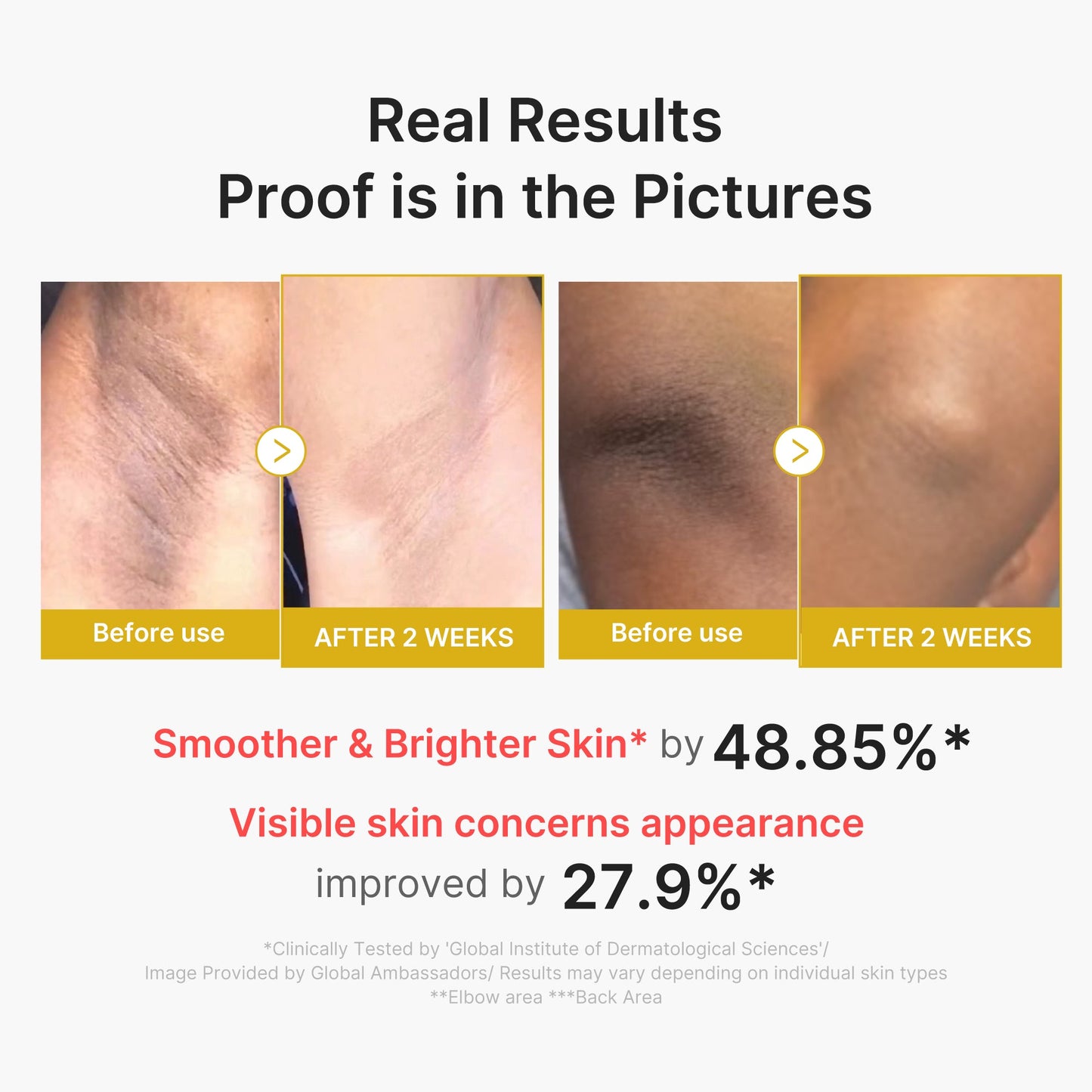 kojic-acid-turmeric-body-peel-shot-h7 02_72880cfc-382b-440b-8152-7e3dce87da2a.jpg