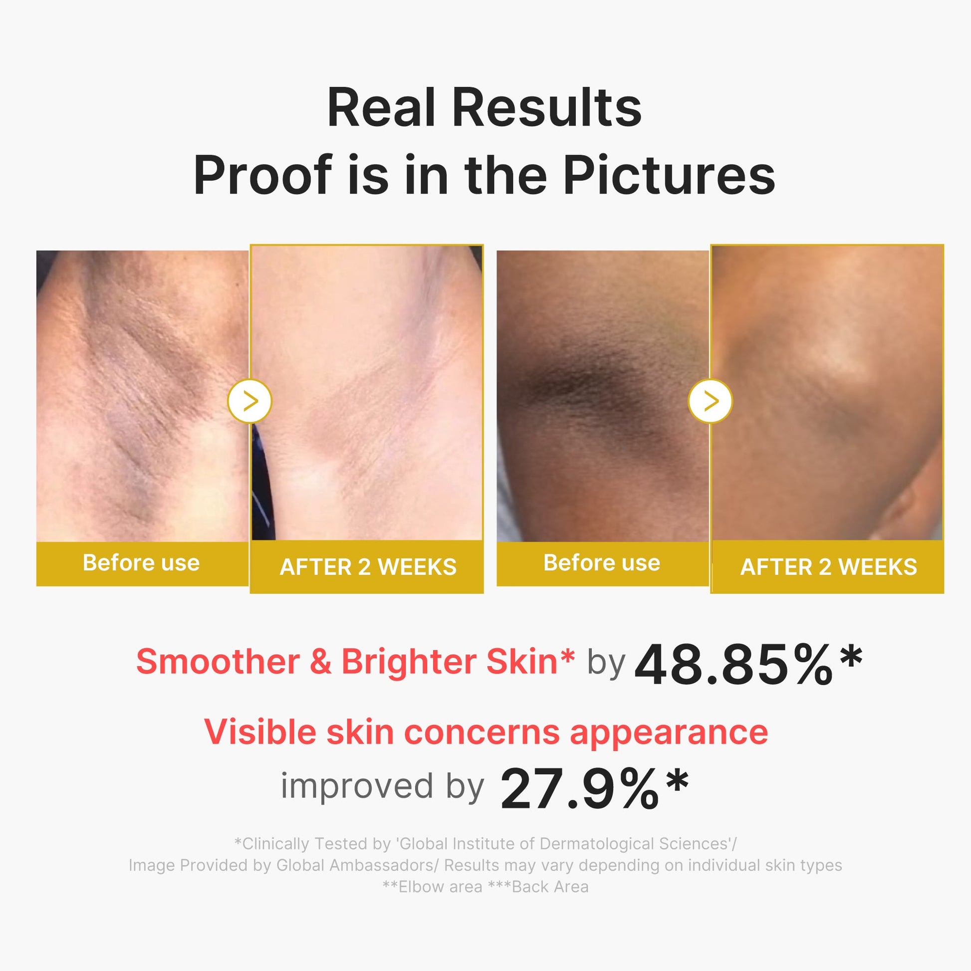 kojic-acid-turmeric-body-peel-shot-h7 02_72880cfc-382b-440b-8152-7e3dce87da2a.jpg