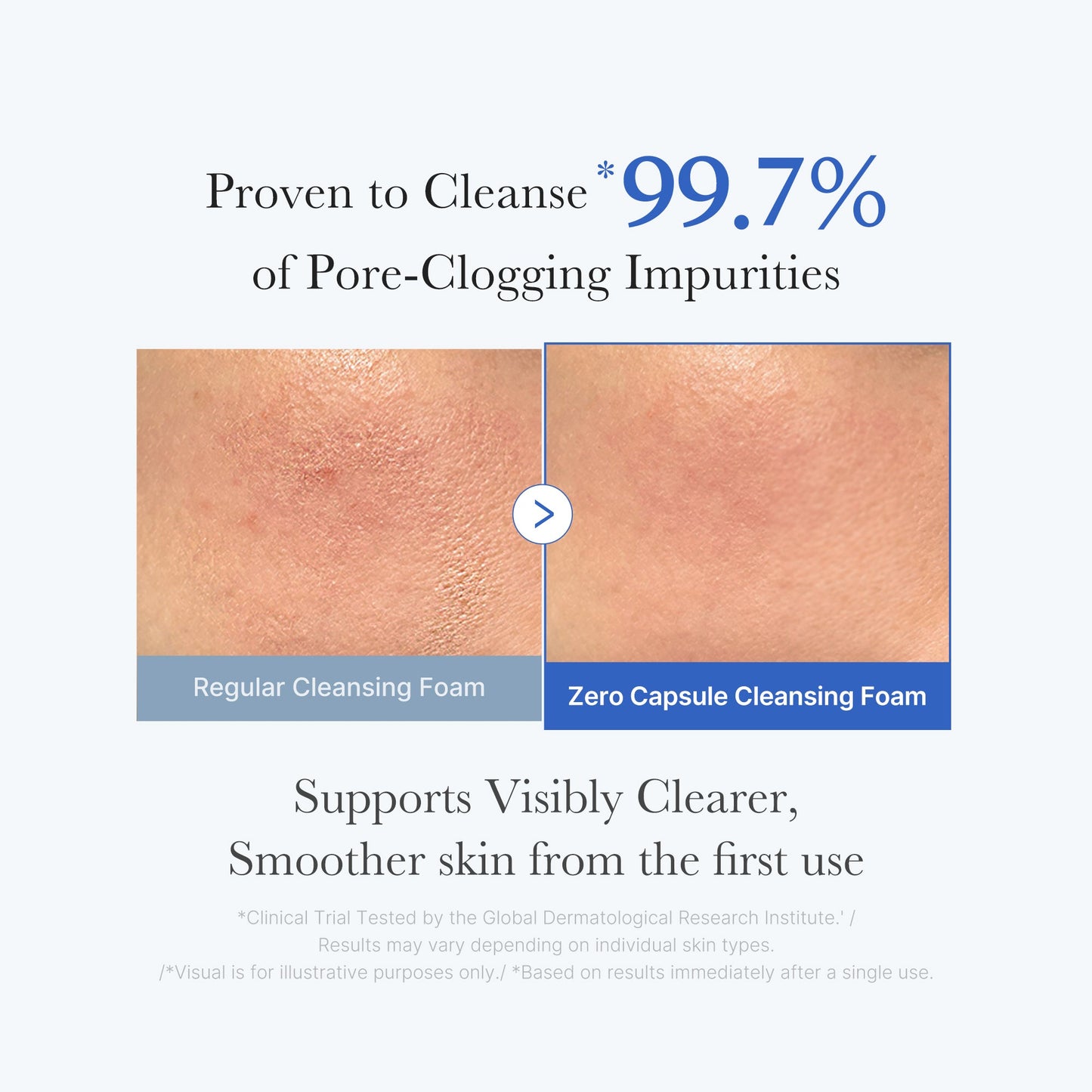 zero-pore-capsule-cleansing-foam-g4 02_c1fb9dfb-86c5-4038-8ff8-490d1006276c.jpg