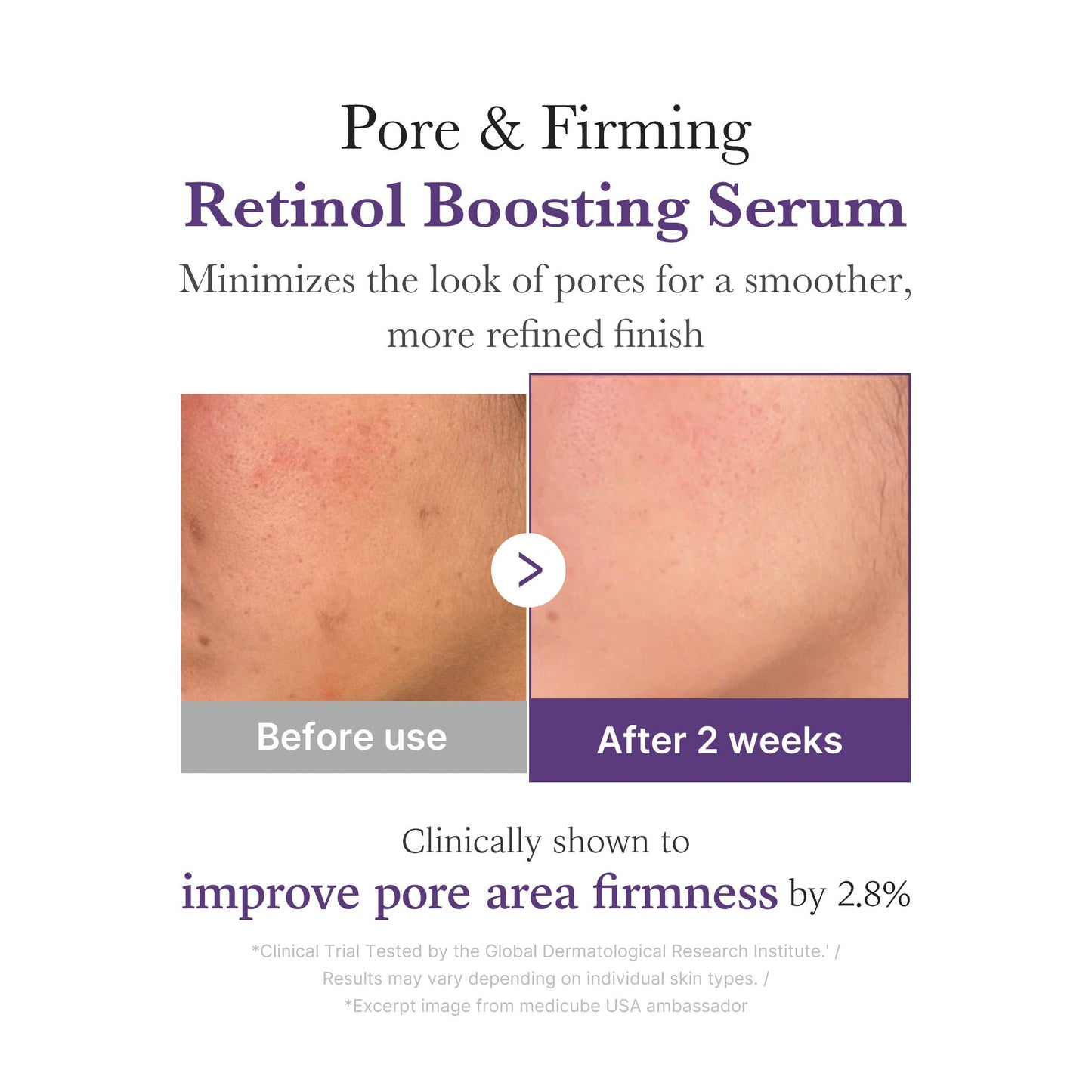 retinol-nmn-boosting-serum-y1 03_3510e7a5-5633-4a18-81ea-1389593bd517.jpg