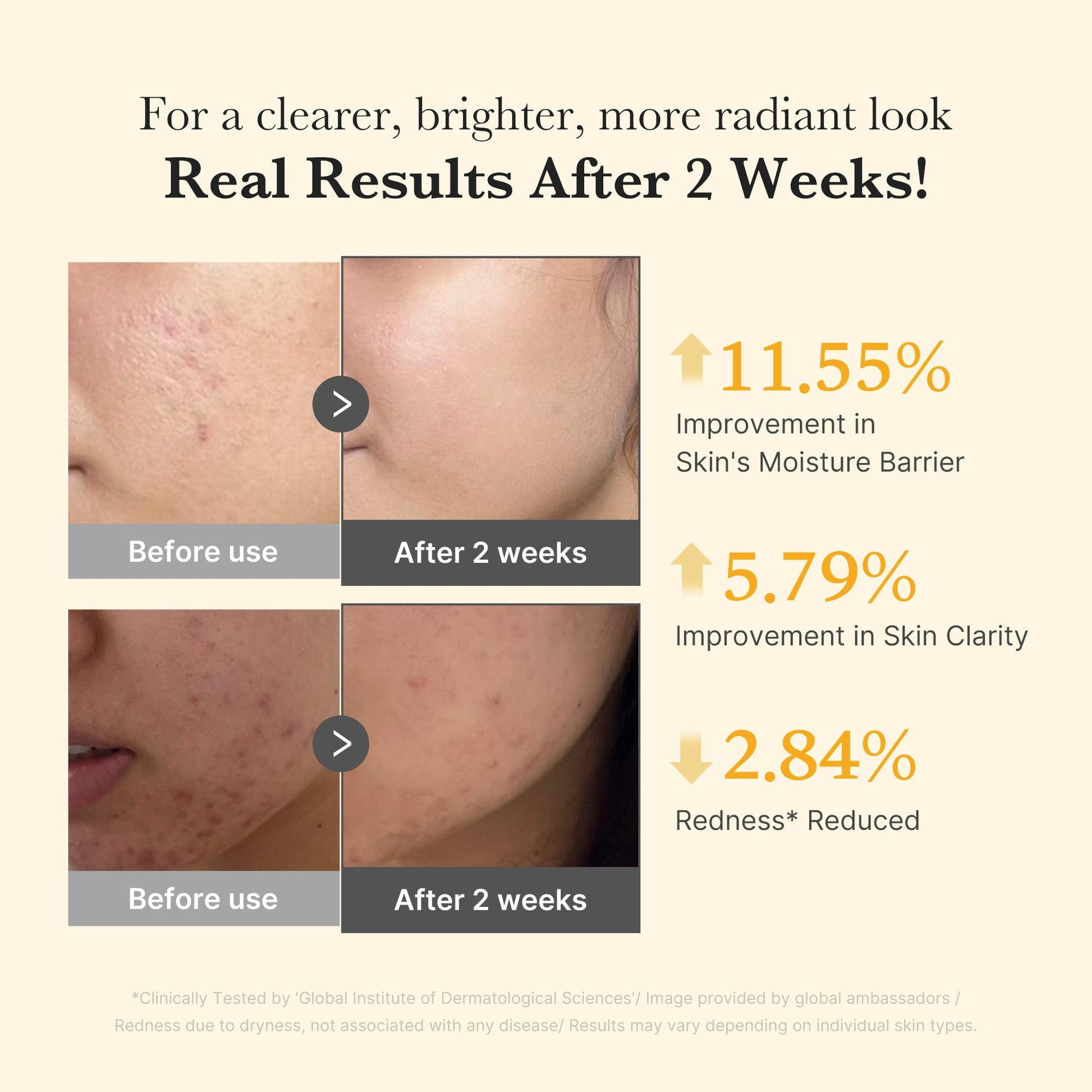 kojic-acid-turmeric-capsule-serum-l9 03_436487f5-76df-490e-8a61-01118373efbd.jpg