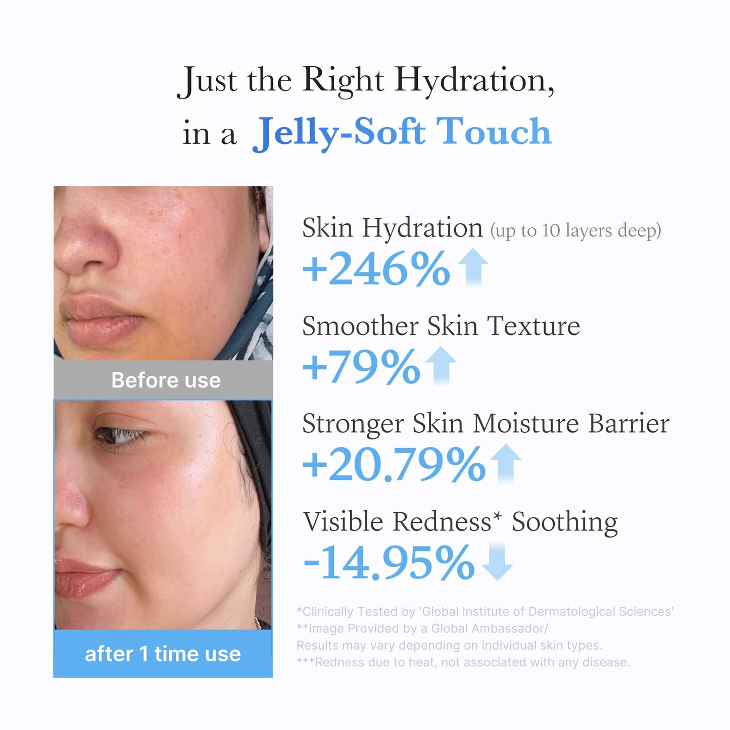 hyaluronic-ceramide-moisturizing-jelly-cream-l7 03_c39d66cc-0839-4e48-ab4a-d32143d06b1c.jpg