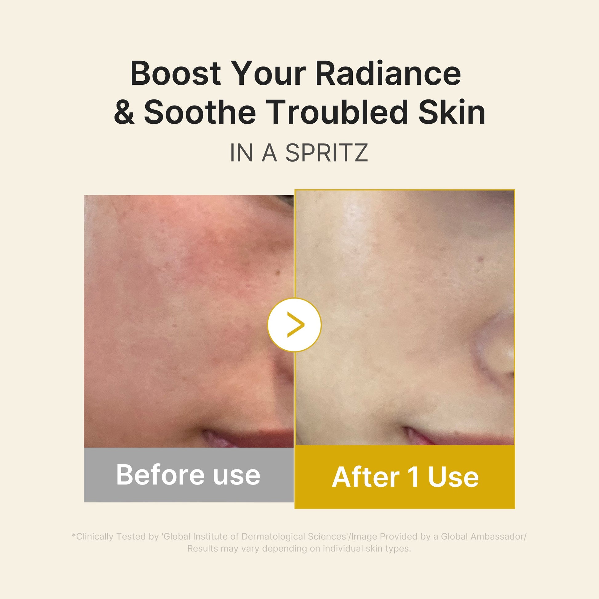 kojic-acid-turmeric-vitamin-gold-jelly-mist-serum-y4 03_dc9cd19e-4e57-49d3-9b66-c7762e8a63f1.jpg