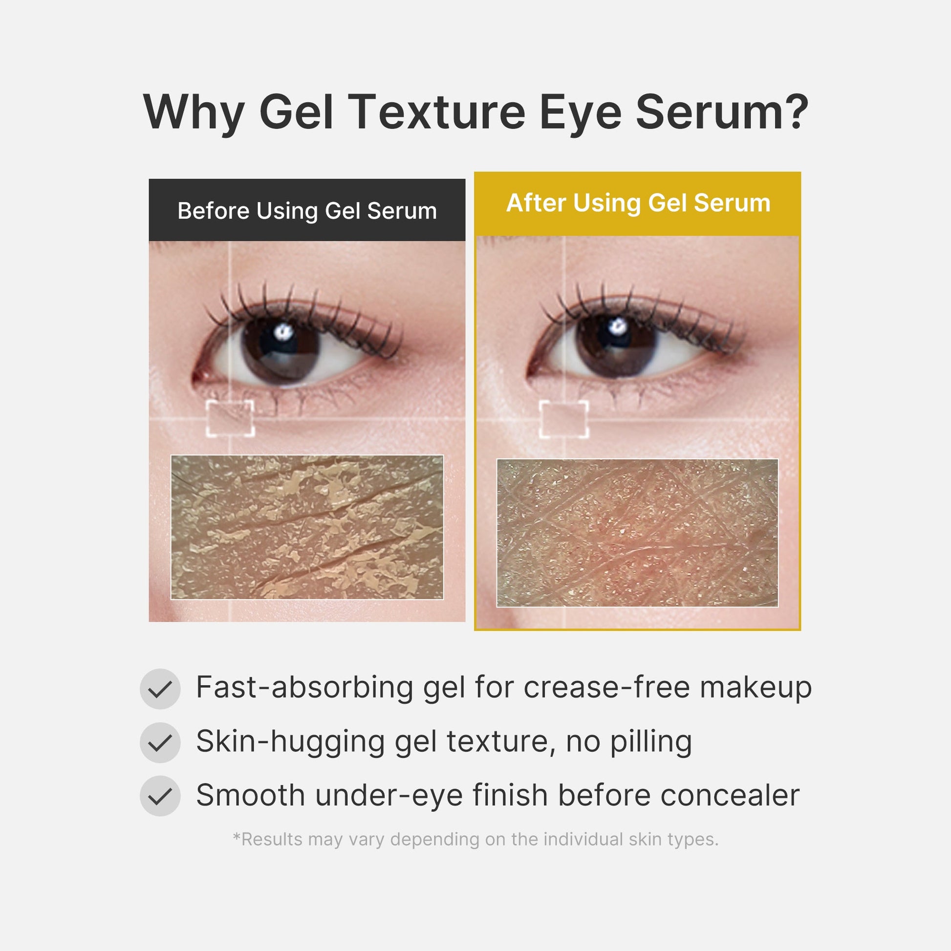 kojic-acid-tumeric-eye-gel-serum-b0 04_0487ef36-49f4-4294-8049-bb55118b05fe.jpg