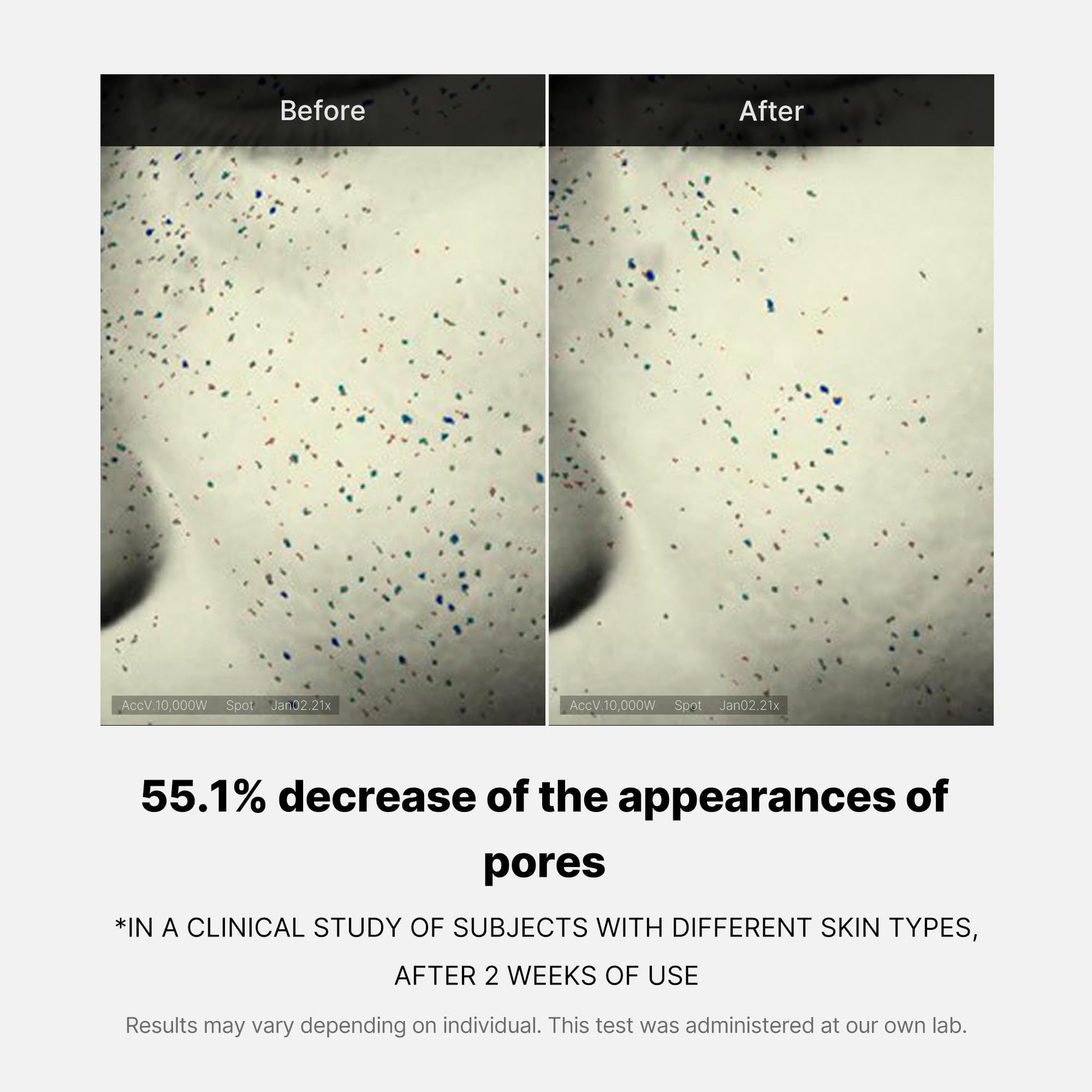 zero-pore-one-day-cream-i2 04_3616addc-f184-4deb-a5d7-e3a782e4713d.jpg