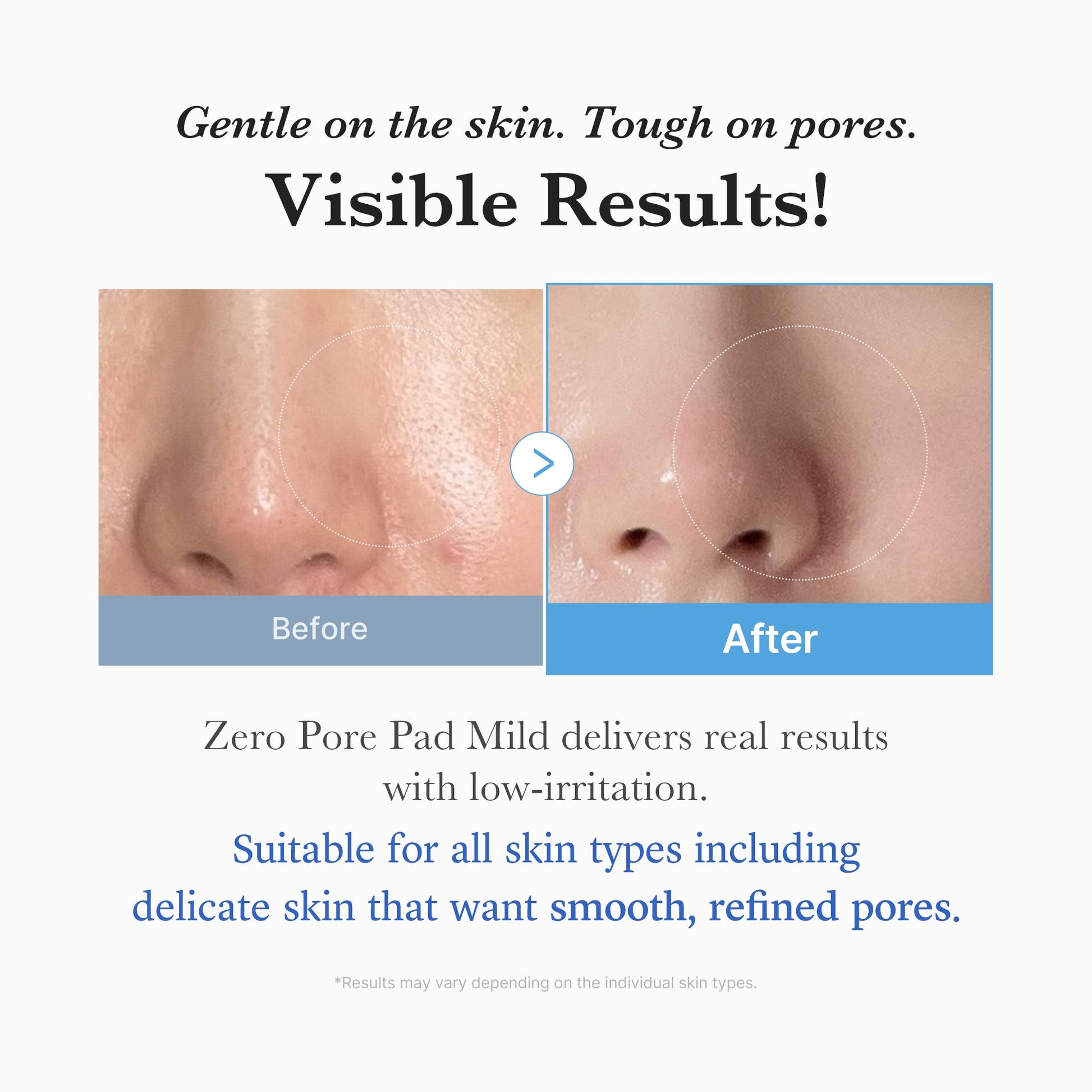 zero-pore-madecassoside-pads-mild-i6 04_6357f9f9-483b-4891-82c6-a58d336e62c8.jpg