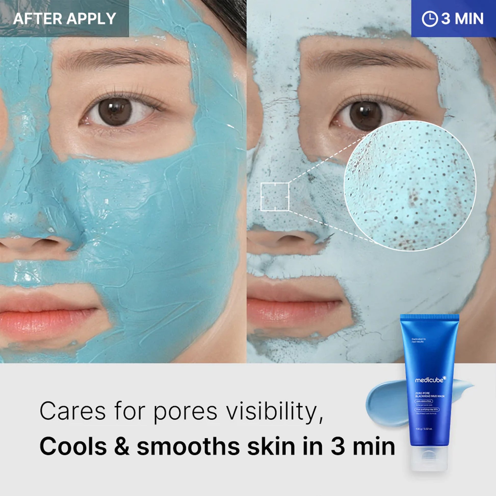 zero-pore-blackhead-mud-mask-s4 04_867c0459-a94e-40d3-bd9a-70400edabe8d.jpg