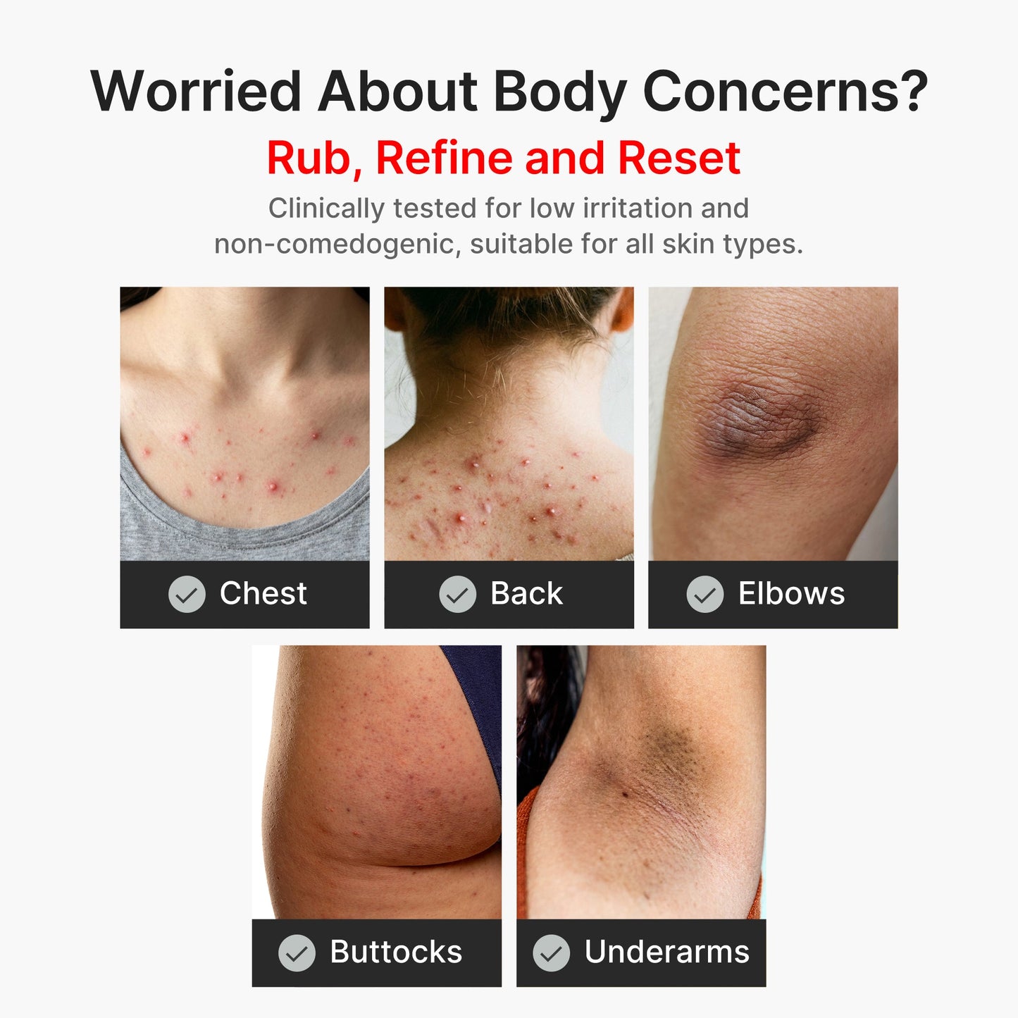 kojic-acid-turmeric-body-peel-shot-h7 04_8a7237f2-3ebf-401e-bd85-54841aeb3efc.jpg