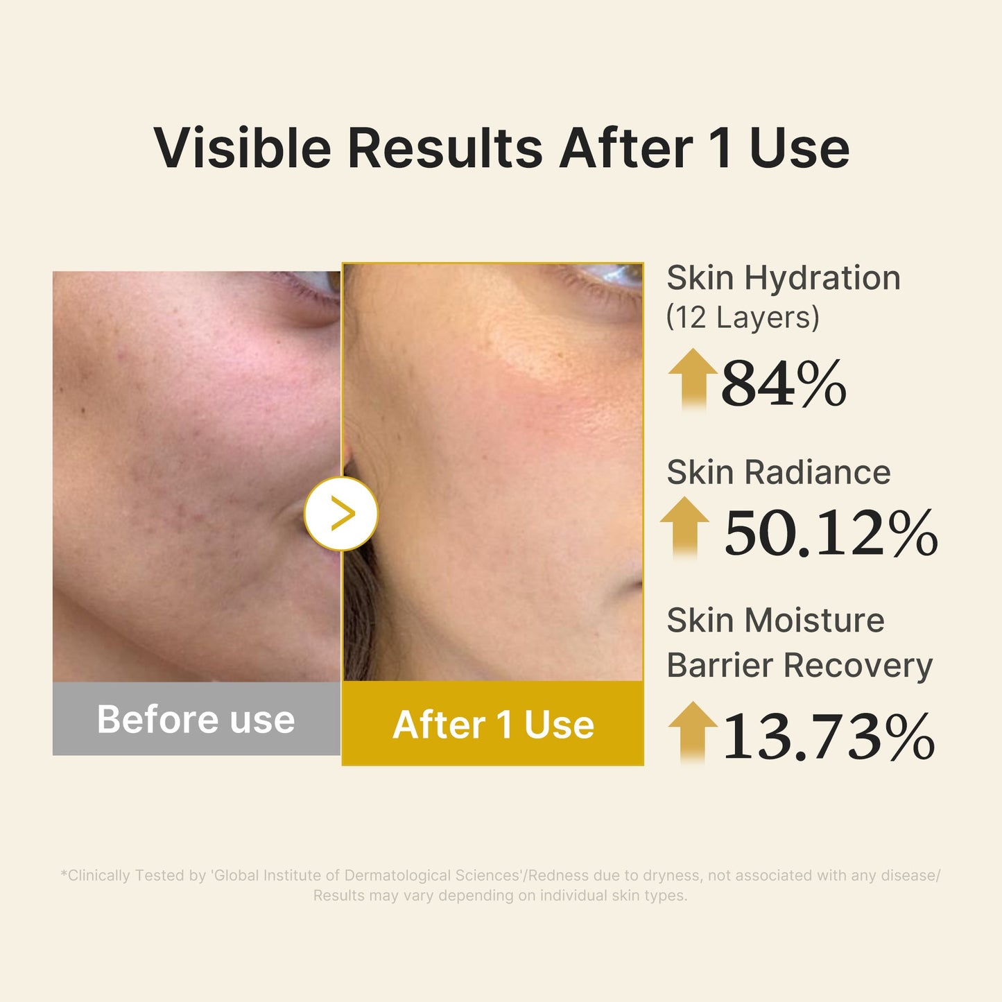 kojic-acid-turmeric-vitamin-gold-jelly-mist-serum-y4 04_d5c55ef1-e03b-494d-bc0d-a1ecc7fc2abf.jpg