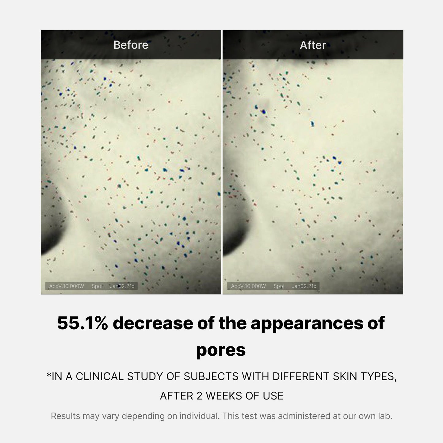 pore-care-duo-i2 05_12ddab8a-64be-4612-8ee1-27e5ec701921.jpg