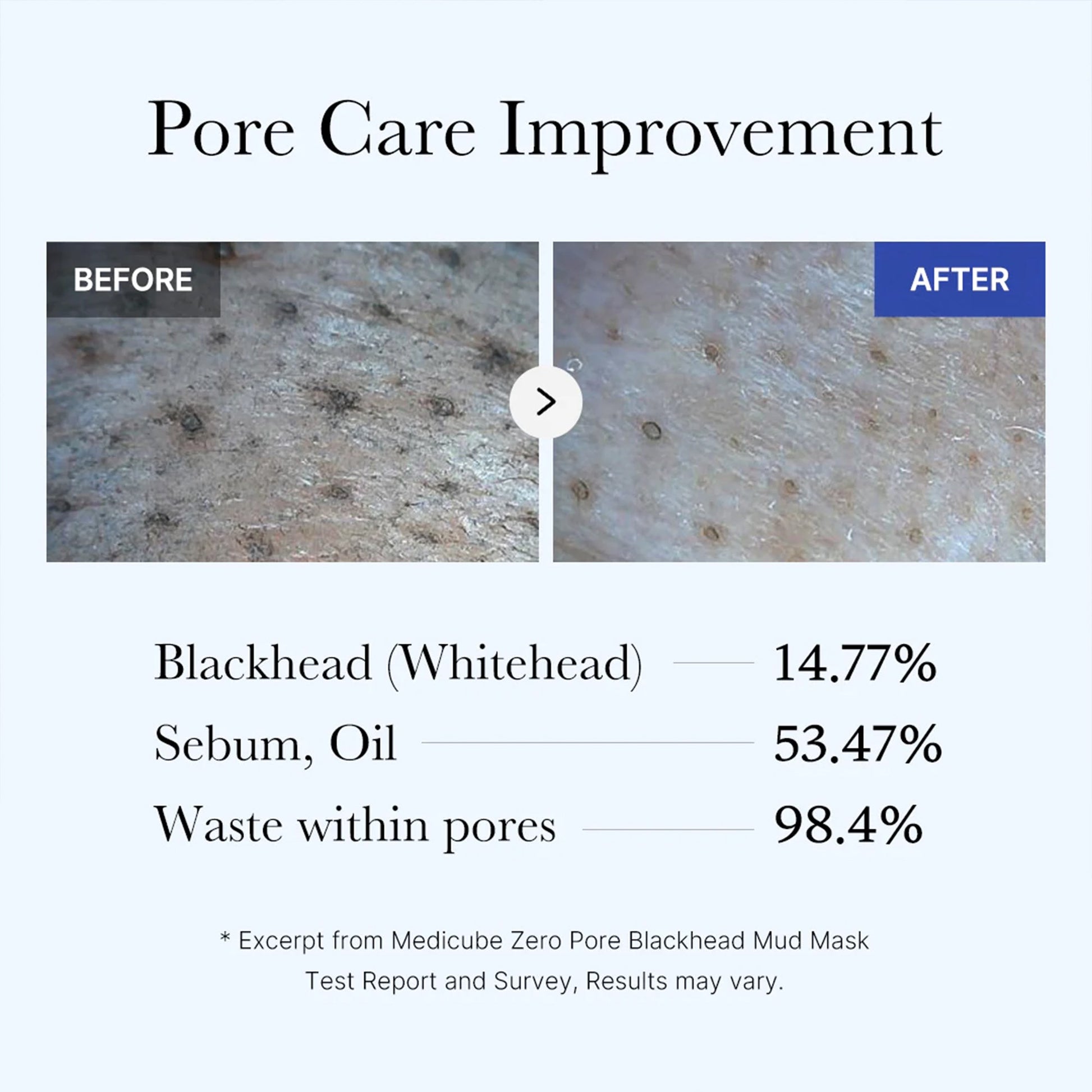 zero-pore-blackhead-mud-mask-s4 05_9362a158-c2b3-4525-acc0-631a2cfdea47.jpg