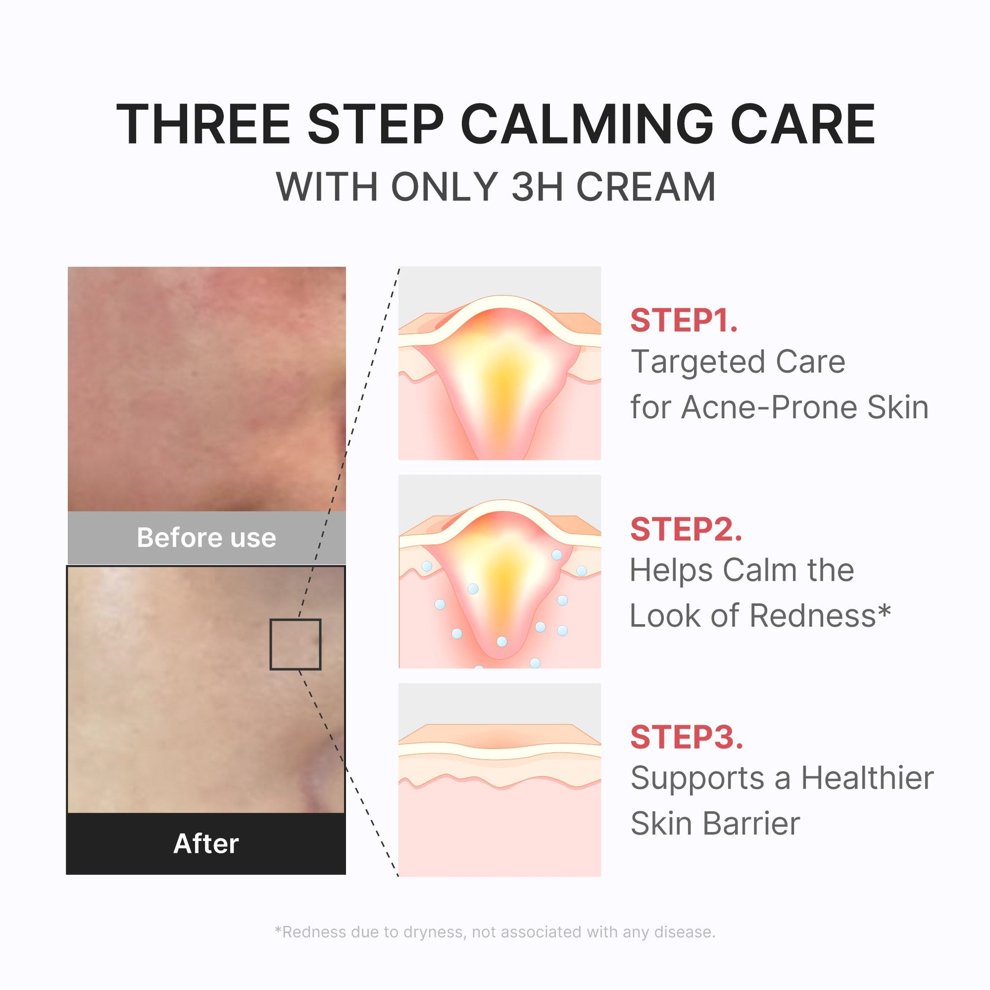 3h-daily-relief-cream-r2 3H_04.jpg
