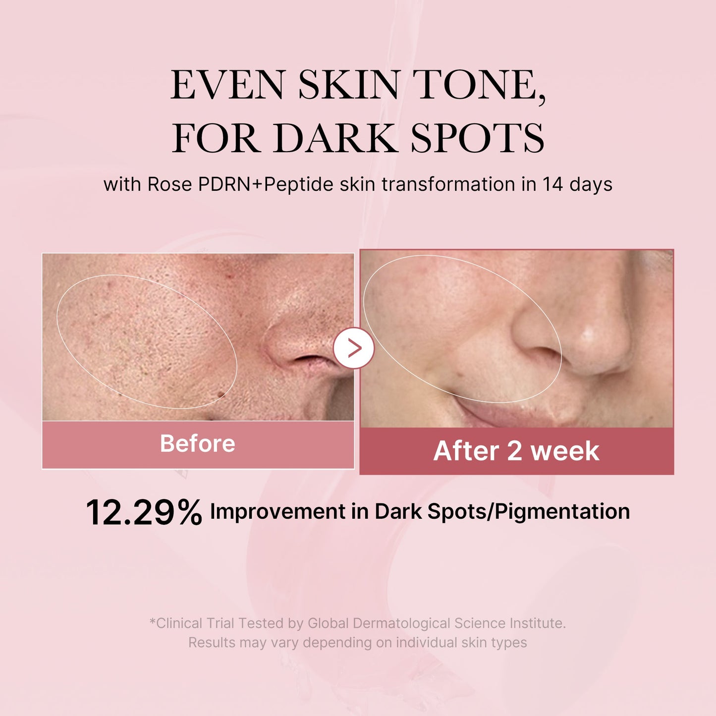 pdrn-pink-peptide-toner-y7 PDRN_01_308c518e-5ac6-4e54-99bd-eabc8796739b.jpg