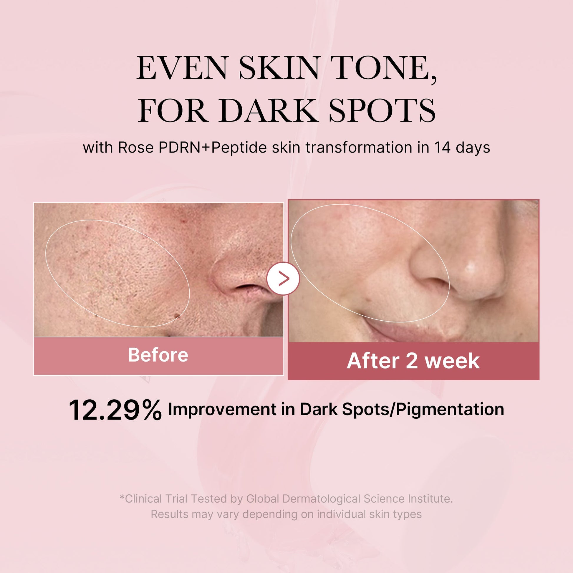 pdrn-pink-peptide-toner-y7 PDRN_01_308c518e-5ac6-4e54-99bd-eabc8796739b.jpg