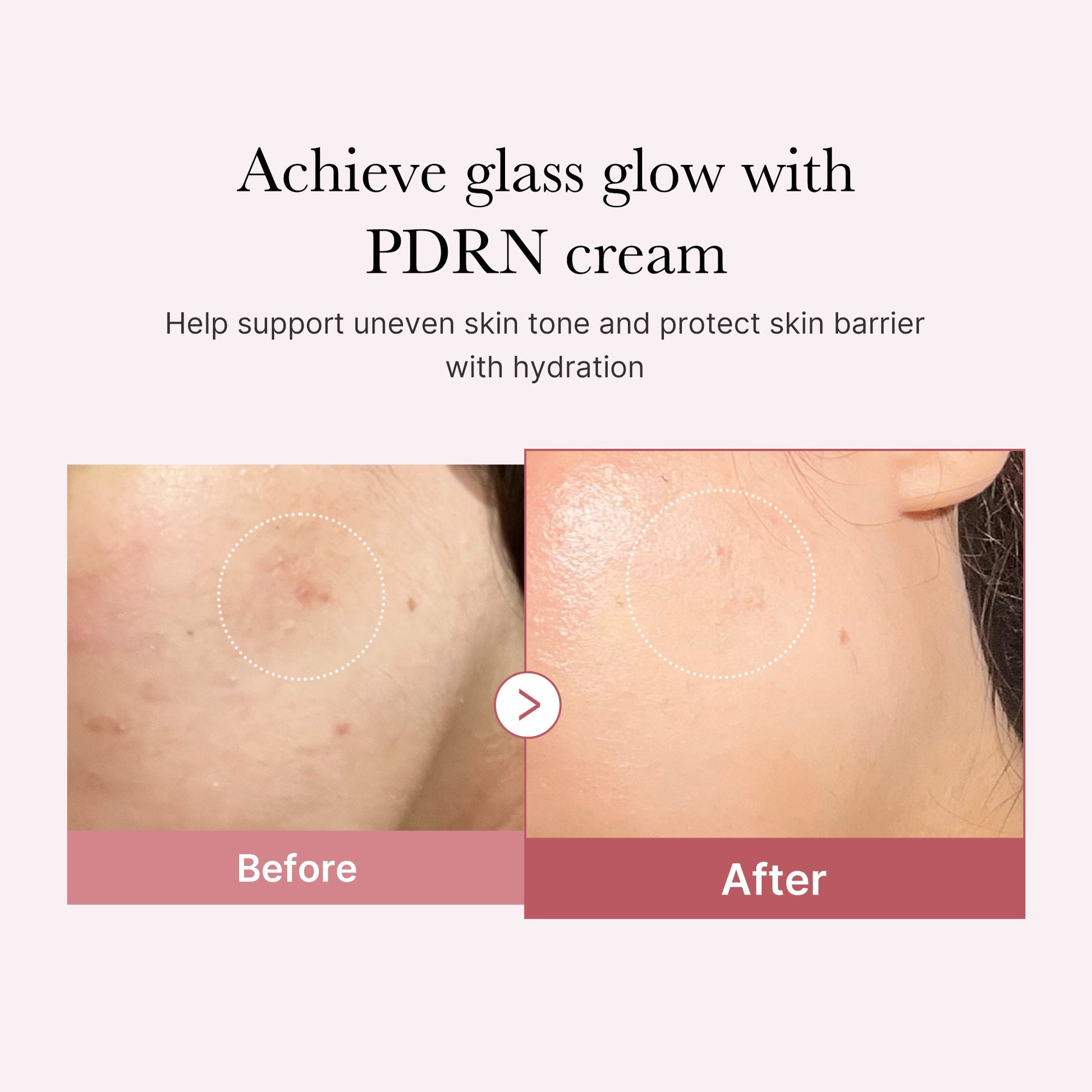 pdrn-pink-peptide-cream-b3 PDRN_02_d7805bfe-cf43-446a-b71b-a276683f136b.jpg