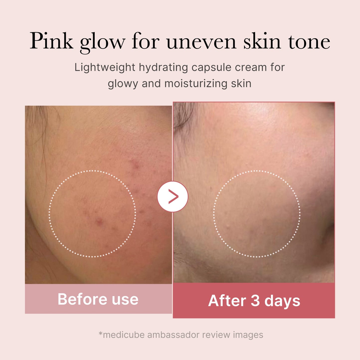 pdrn-pink-collagen-capsule-cream-l3 PDRN_03_058d09d8-4f44-4b1e-927c-e27b1738ae51.jpg