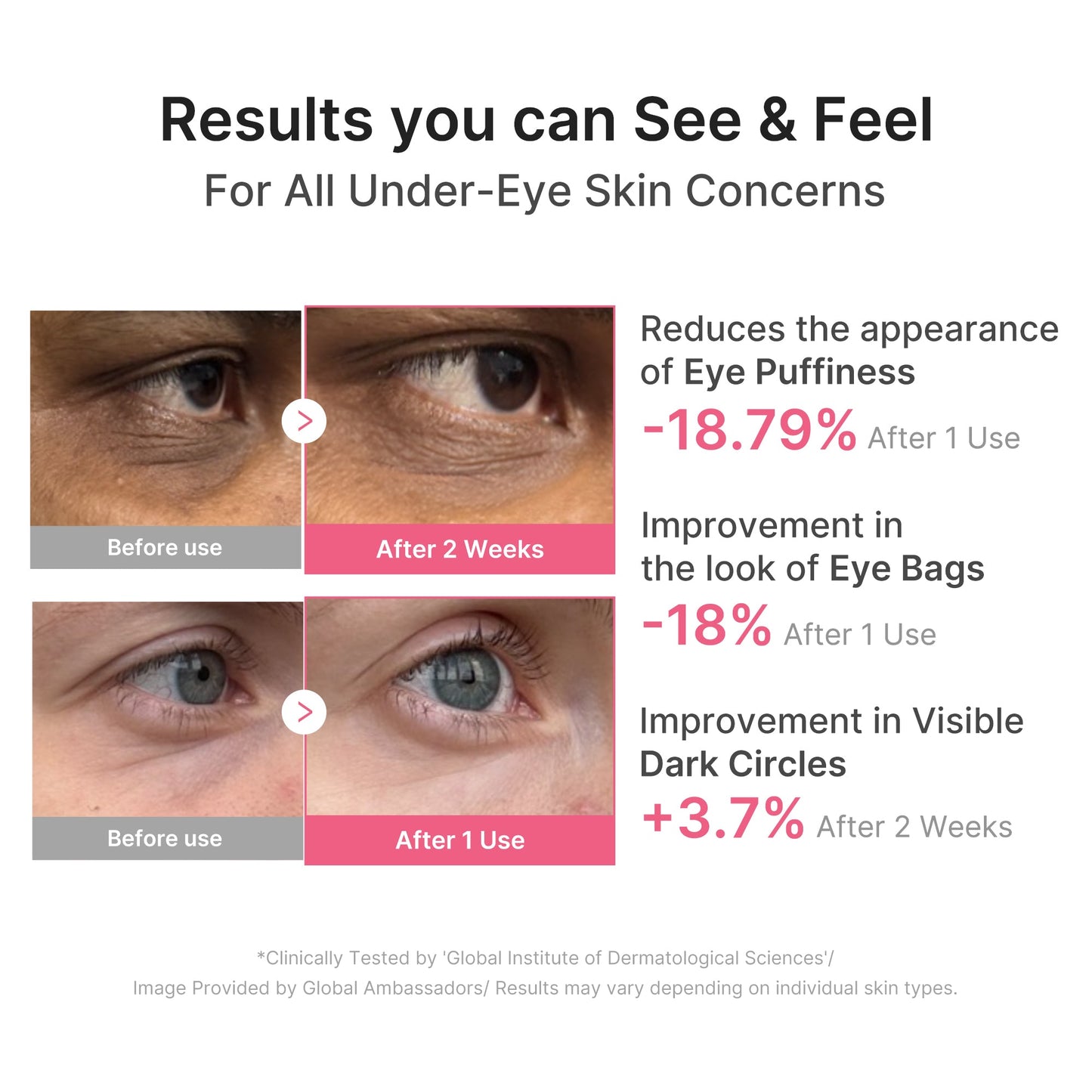 pdrn-caffeine-collagen-eye-patch-r1 PDRN_03_cdce2143-b8d8-43cb-ac69-fcbdf6640249.jpg