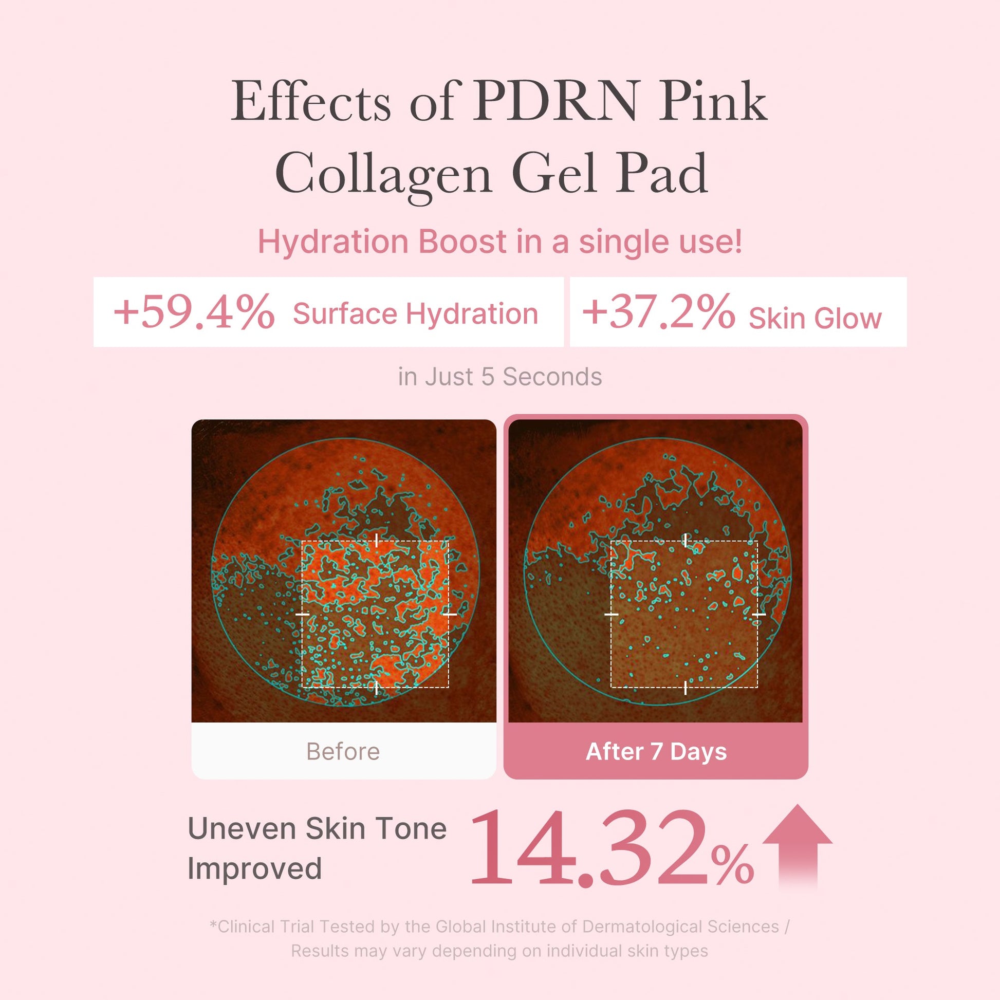 pdrn-pink-collagen-gel-toner-pad-k8 PDRN_04_f9a16a56-8d9e-4c47-a635-ed34ec3ed571.jpg