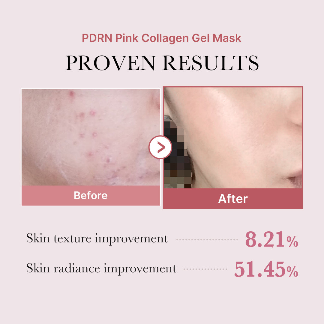 pdrn-pink-glow-full-set-r1 PDRN_12.jpg